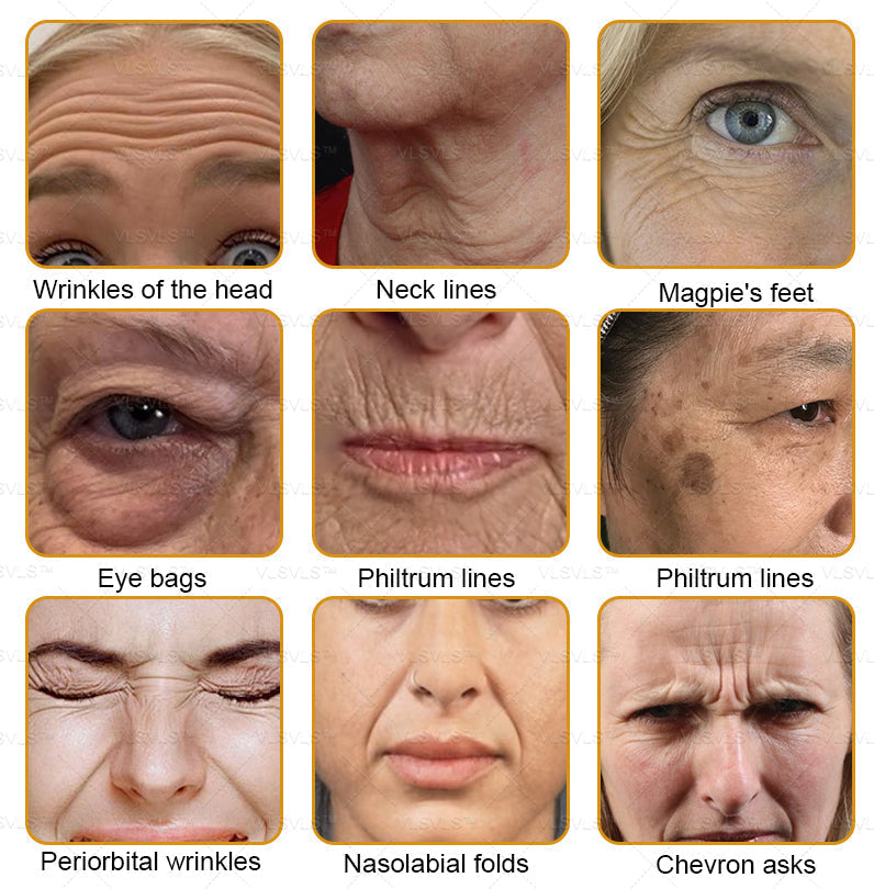 Bee Essence Skin Antibacterial Cream—used to treat a variety of skin diseases (AAD recommended)