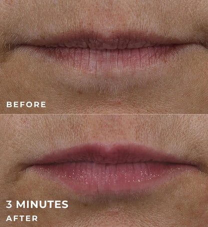 Correxion Lip Volumizer 