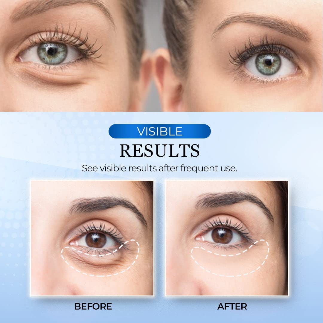 New rechargeable Vibration Eye Massager with Heat