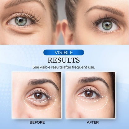 New rechargeable Vibration Eye Massager with Heat